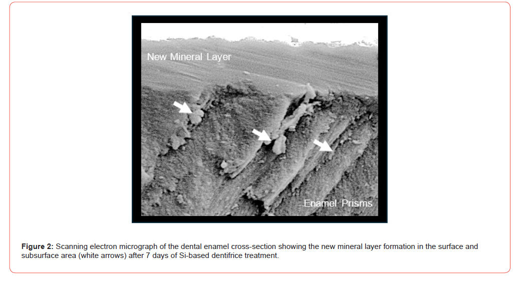 Click here to view Large Figure 2 irispublishers-openaccess-pediatrics-neonatal-care