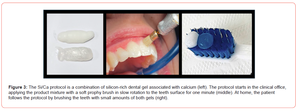 Click here to view Large Figure 3 irispublishers-openaccess-pediatrics-neonatal-care