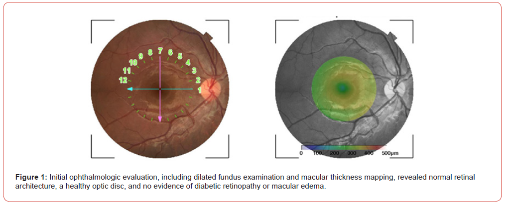 Click here to view Large Figure 1 irispublishers-openaccess-pediatrics-neonatal-care