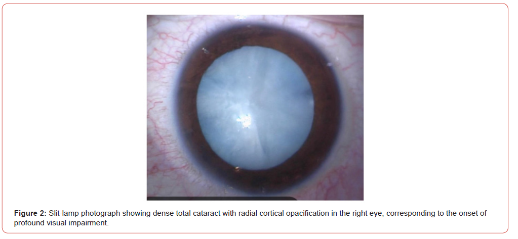 Click here to view Large Figure 2 irispublishers-openaccess-pediatrics-neonatal-care