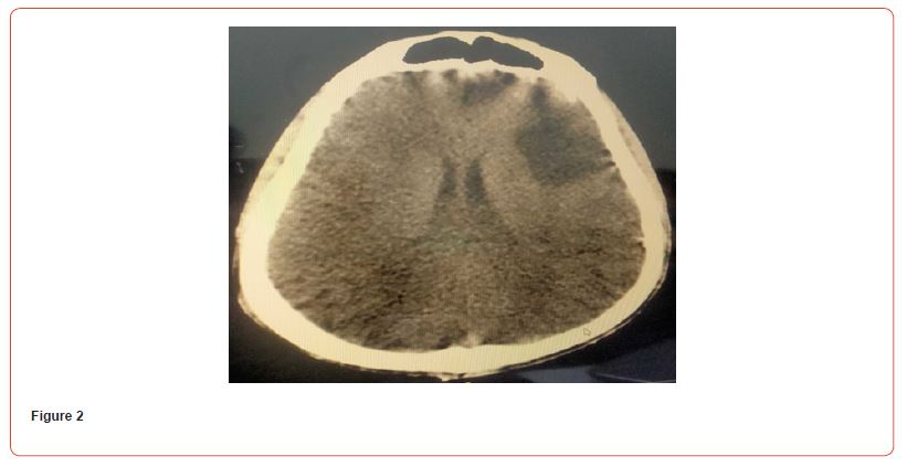Click here to view Large Figure 2 irispublishers-openaccess-dentistry-oral-health