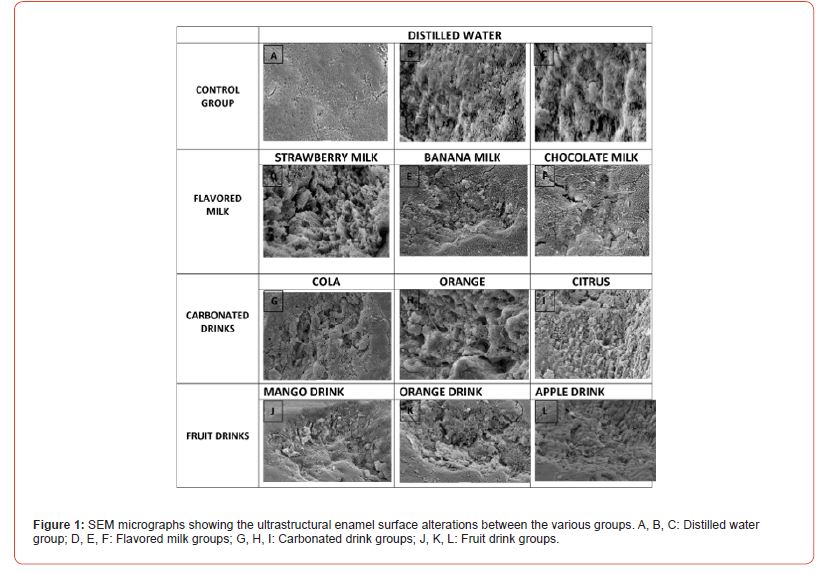 Click here to view Large Figure 1 irispublishers-openaccess-dentistry-oral-health