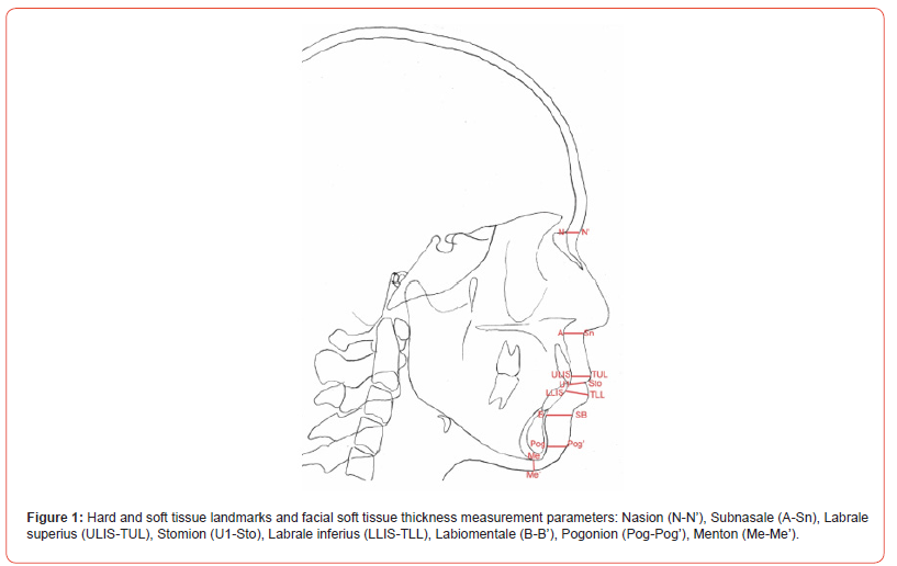 Click here to view Large Figure 1 irispublishers-openaccess-dentistry-oral-health