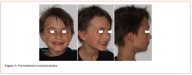 Click here to view Large Figure 1 irispublishers-openaccess-dentistry-oral-health