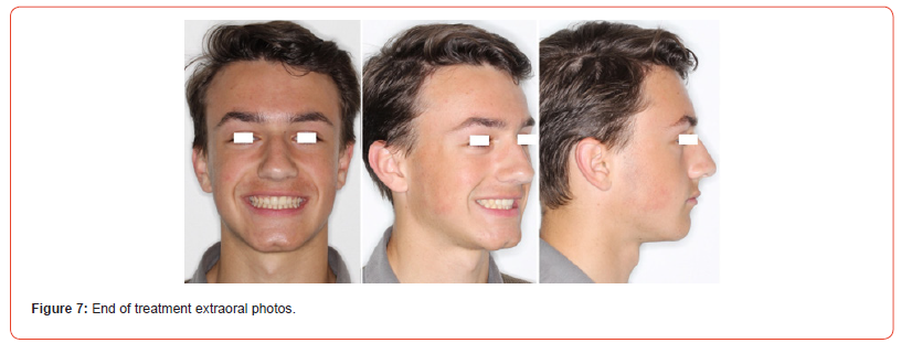 Click here to view Large Figure 7 irispublishers-openaccess-dentistry-oral-health