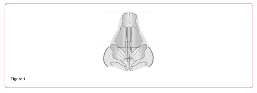 Click here to view Large Figure 1 irispublishers-openaccess-dentistry-oral-health