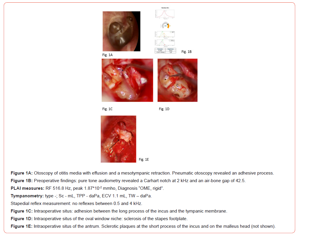 Click here to view Large Figure 1 irispublishers-openaccess-dentistry-oral-health