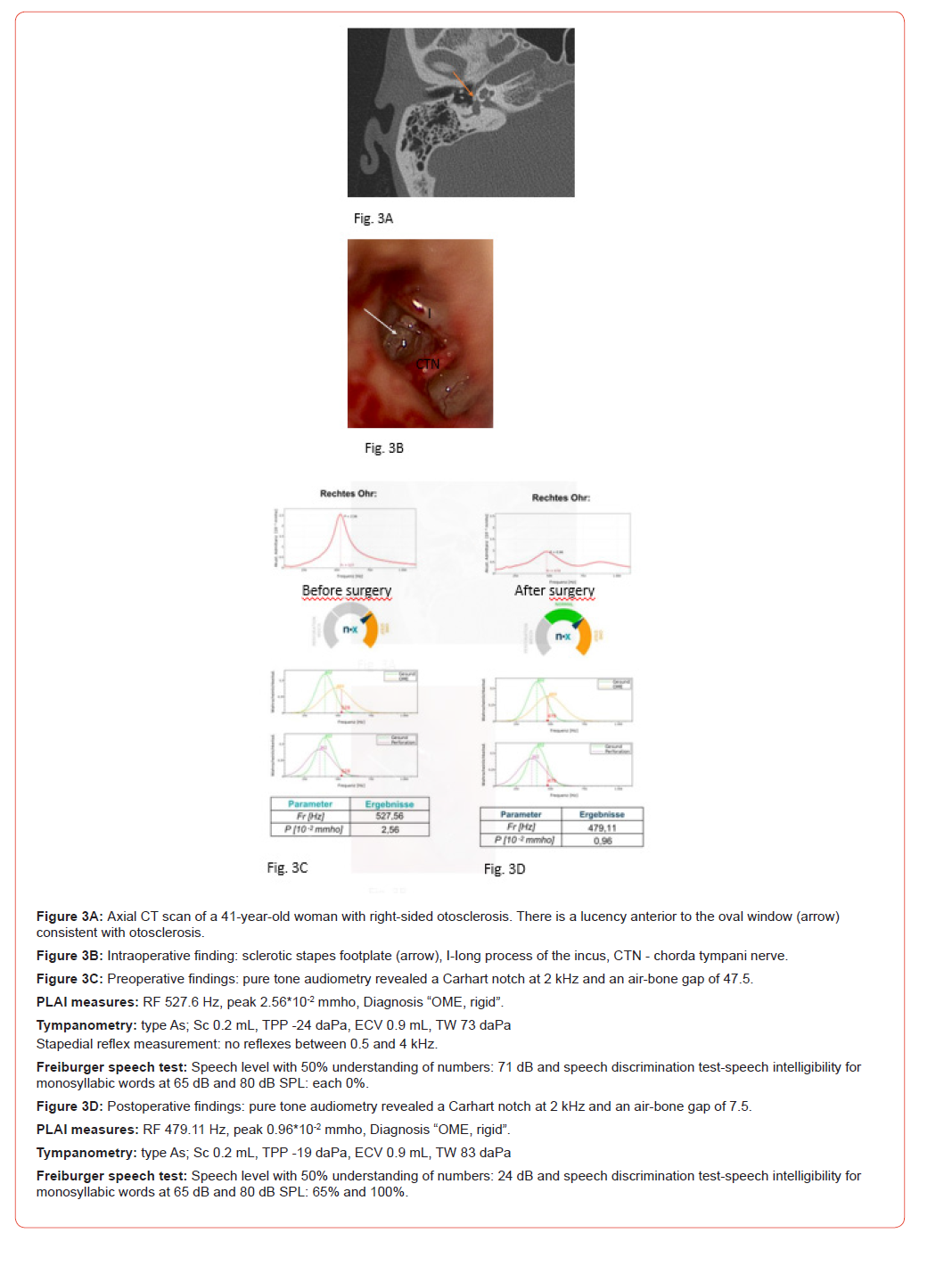 Click here to view Large Figure 3 irispublishers-openaccess-dentistry-oral-health
