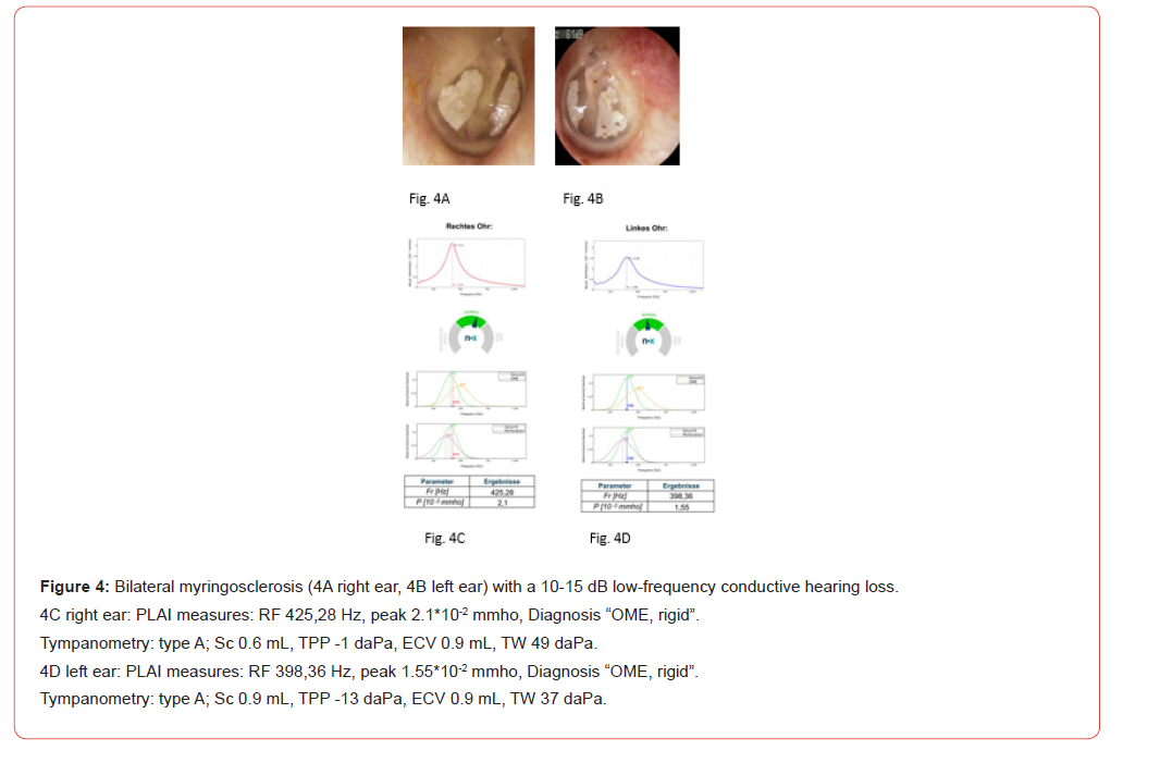 Click here to view Large Figure 4 irispublishers-openaccess-dentistry-oral-health