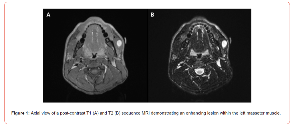 Click here to view Large Figure 1 irispublishers-openaccess-dentistry-oral-health