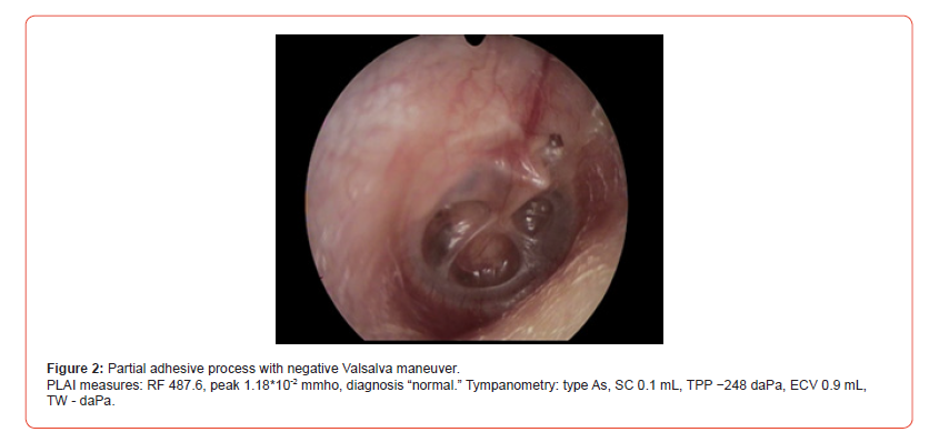 Click here to view Large Figure 2 irispublishers-openaccess-dentistry-oral-health