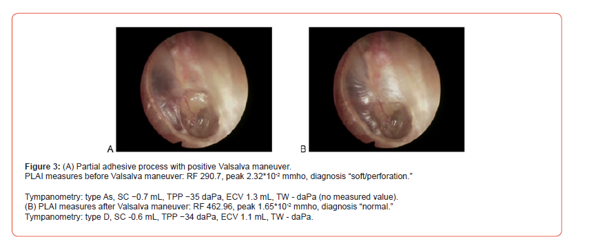 Click here to view Large Figure 3 irispublishers-openaccess-dentistry-oral-health