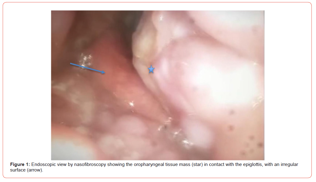 Click here to view Large Figure 1 irispublishers-openaccess-dentistry-oral-health