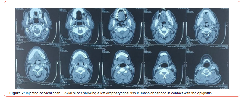 Click here to view Large Figure 2 irispublishers-openaccess-dentistry-oral-health