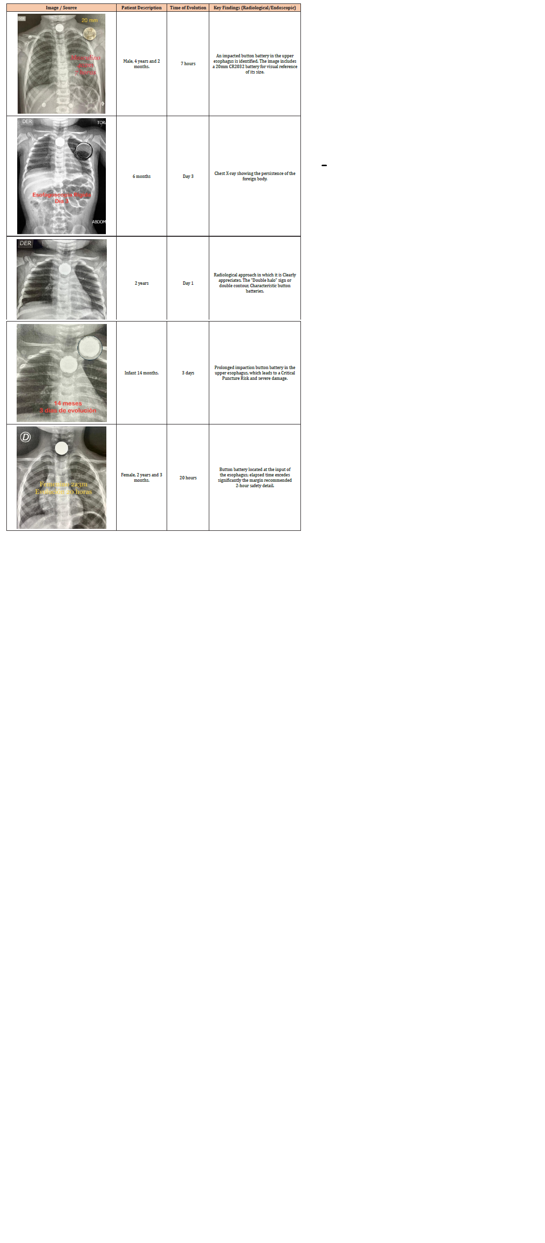 Click here to view Large Figure 1 irispublishers-openaccess-dentistry-oral-health