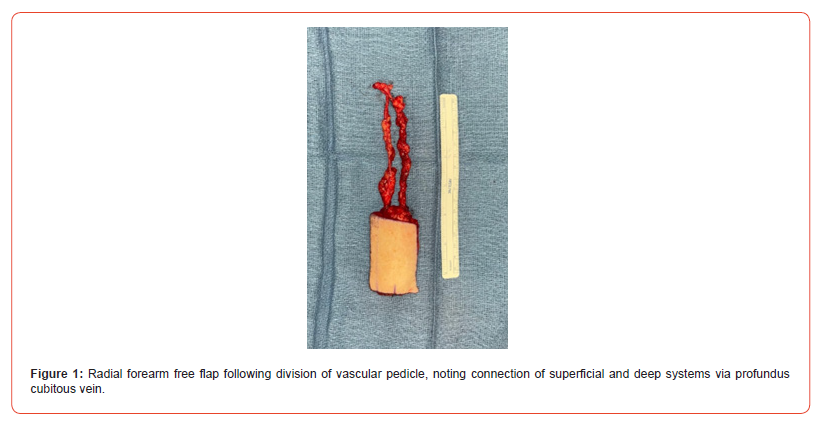 Click here to view Large Figure 1 irispublishers-openaccess-dentistry-oral-health