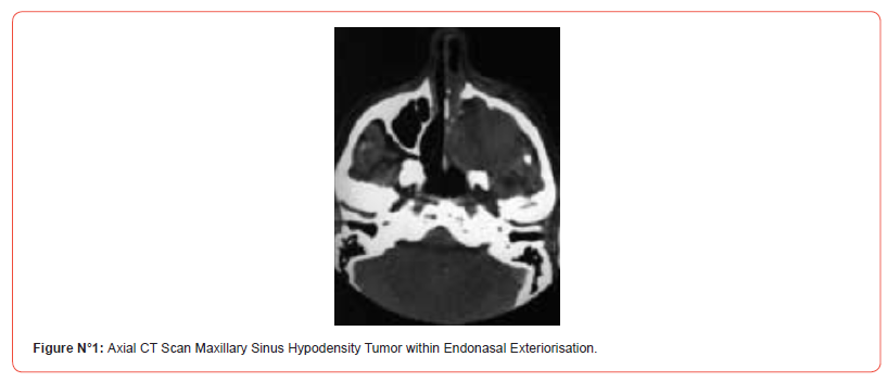 Click here to view Large Figure 1 irispublishers-openaccess-dentistry-oral-health