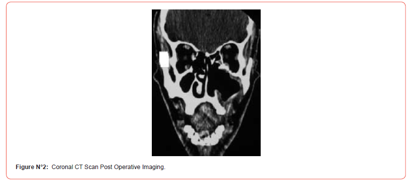Click here to view Large Figure 2 irispublishers-openaccess-dentistry-oral-health