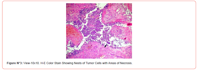 Click here to view Large Figure 3 irispublishers-openaccess-dentistry-oral-health