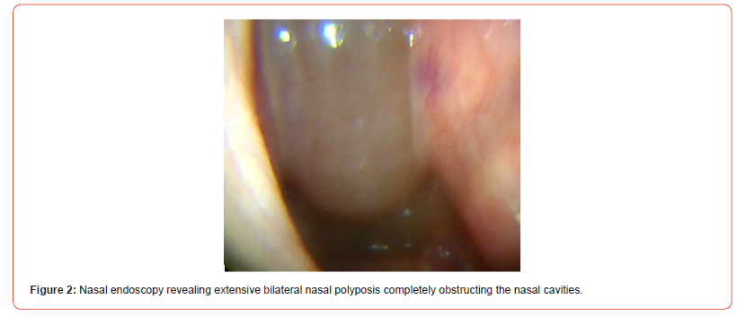 Click here to view Large Figure 2 irispublishers-openaccess-dentistry-oral-health