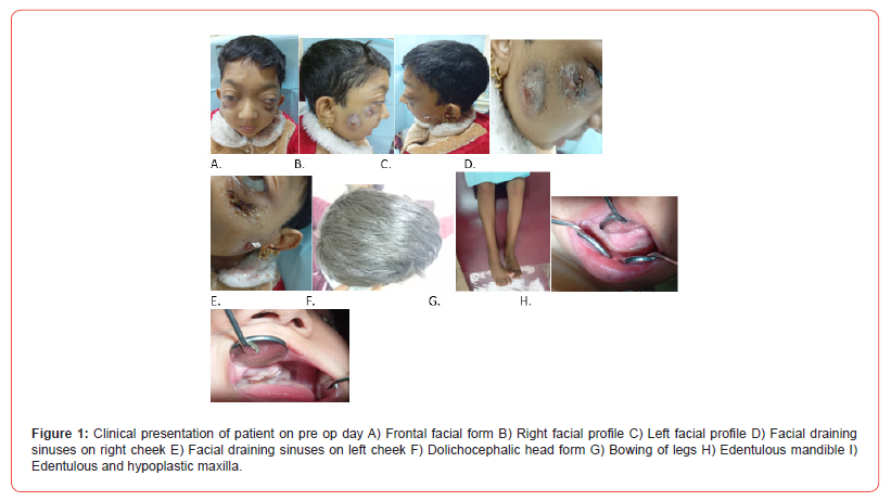 Click here to view Large Figure 1 irispublishers-openaccess-dentistry-oral-health