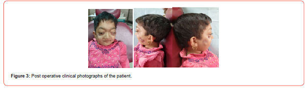 Click here to view Large Figure 3 irispublishers-openaccess-dentistry-oral-health