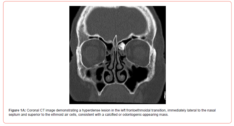 Click here to view Large Figure 1 irispublishers-openaccess-dentistry-oral-health