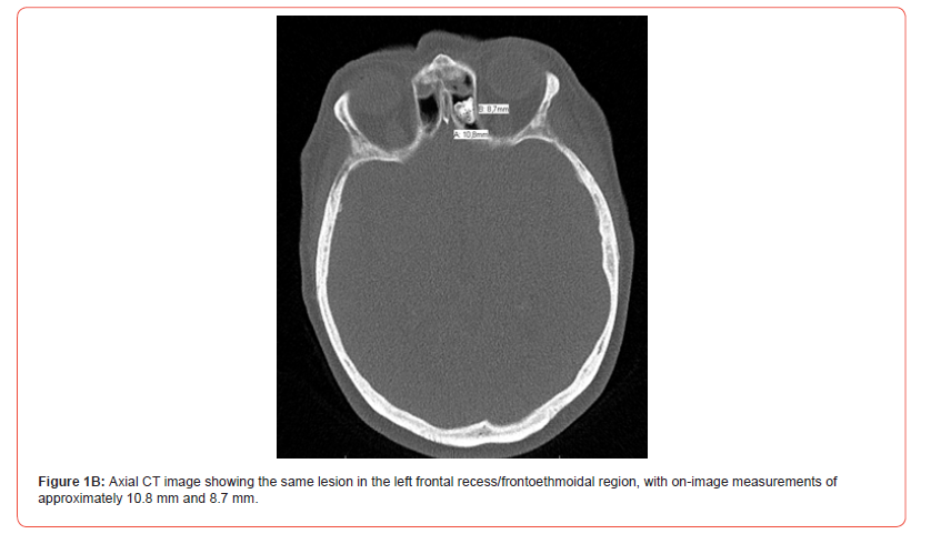 Click here to view Large Figure 2 irispublishers-openaccess-dentistry-oral-health