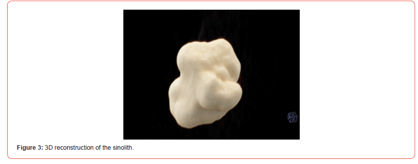 Click here to view Large Figure 5 irispublishers-openaccess-dentistry-oral-health