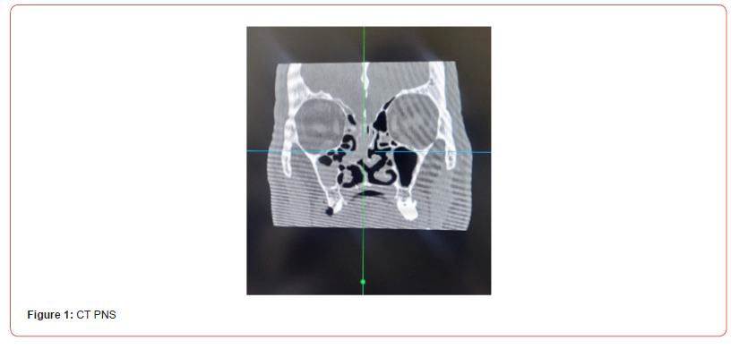 Click here to view Large Figure 1 irispublishers-openaccess-dentistry-oral-health