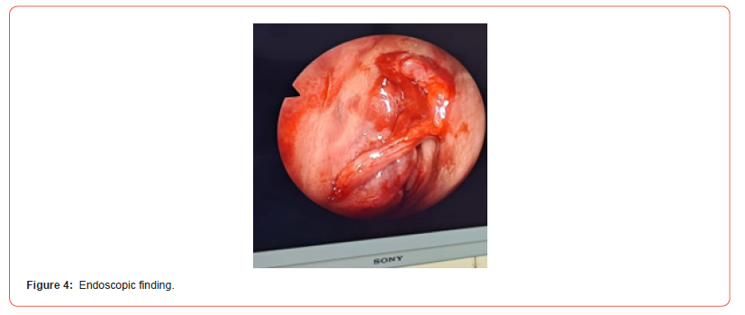 Click here to view Large Figure 4 irispublishers-openaccess-dentistry-oral-health