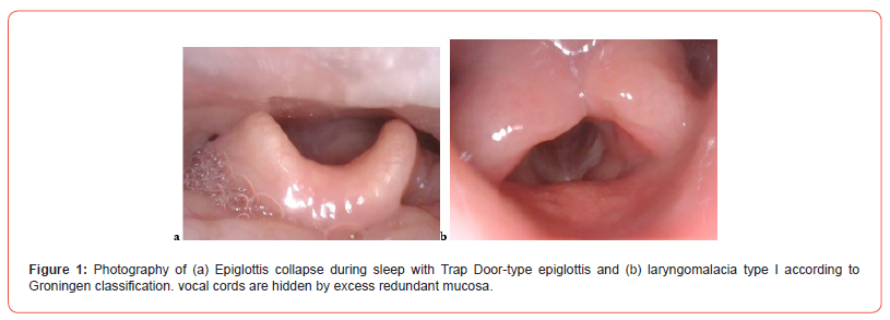 Click here to view Large Figure 1 irispublishers-openaccess-dentistry-oral-health