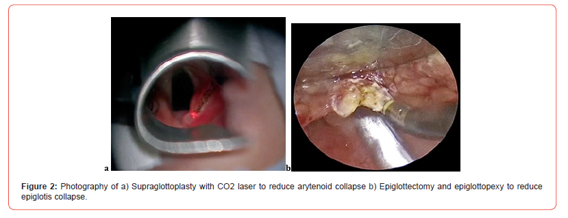 Click here to view Large Figure 2 irispublishers-openaccess-dentistry-oral-health