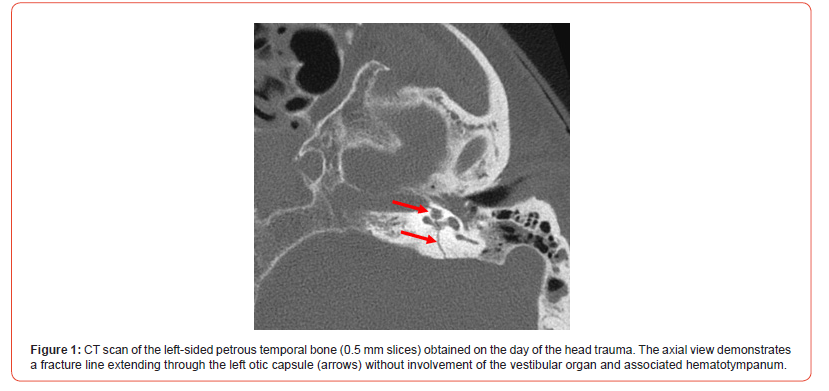 Click here to view Large Figure 1 irispublishers-openaccess-dentistry-oral-health