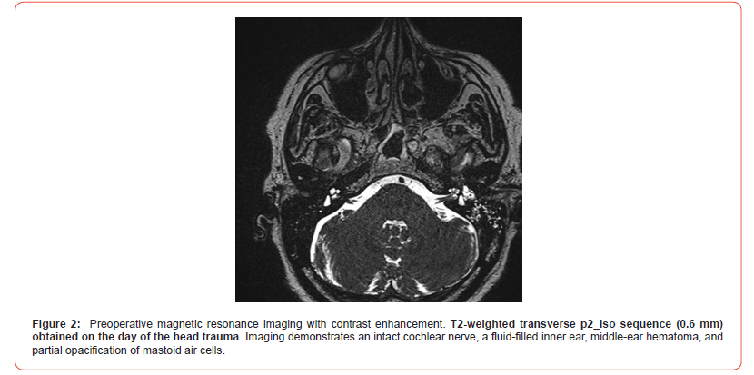Click here to view Large Figure 2 irispublishers-openaccess-dentistry-oral-health
