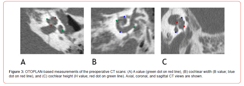Click here to view Large Figure 3 irispublishers-openaccess-dentistry-oral-health