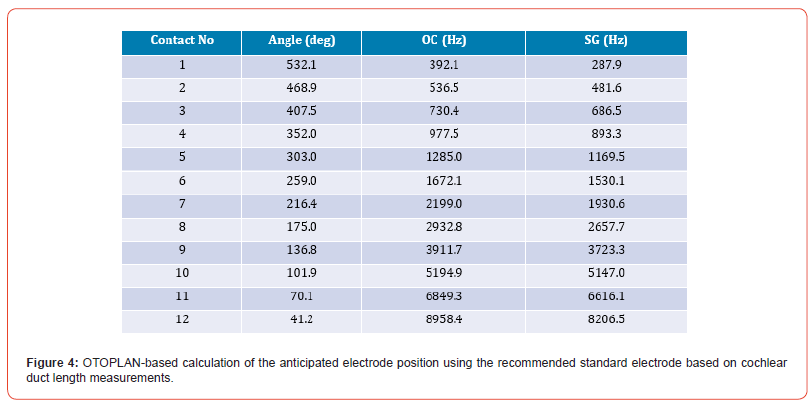 Click here to view Large Figure 4 irispublishers-openaccess-dentistry-oral-health
