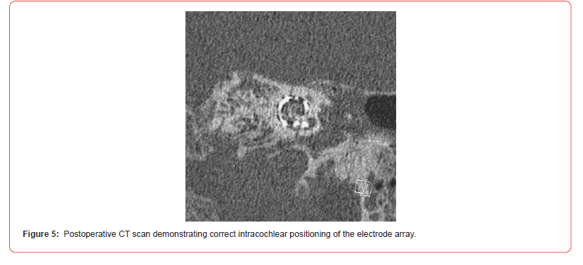 Click here to view Large Figure 5 irispublishers-openaccess-dentistry-oral-health