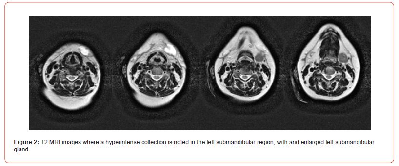 Click here to view Large Figure 2 irispublishers-openaccess-textile-science-fashion