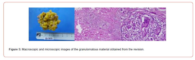 Click here to view Large Figure 5 irispublishers-openaccess-textile-science-fashion