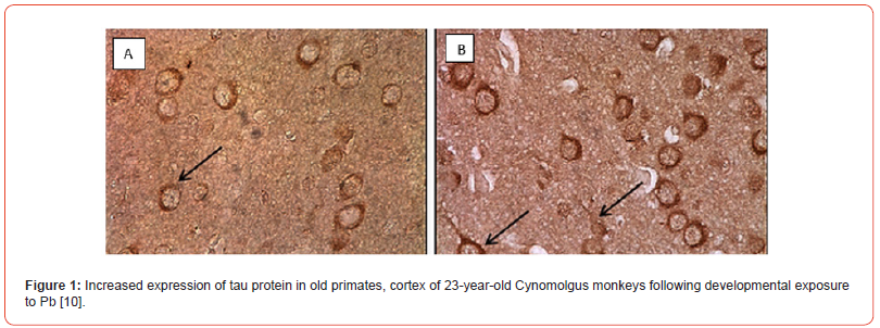 Click here to view Large Figure 1 irispublishers-open-journal-of-pathology-toxicology-research