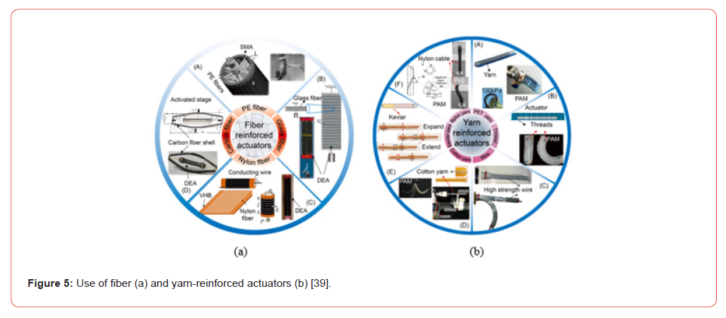 Click here to view Large Figure 5 irispublishers-openaccess-orthopedics-research