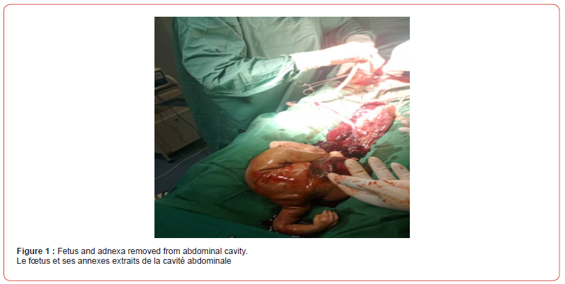 Click here to view Large Figure 1 irispublishers-openaccess-gynecology-womens-health