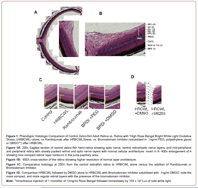 Click here to view Large Figure 1 irispublishers-openaccess-ophthalmology-vision-research