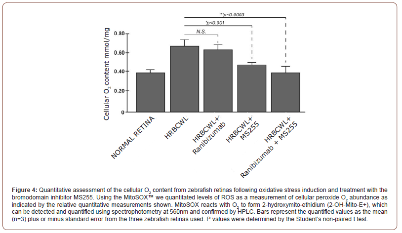Click here to view Large Figure 4 irispublishers-openaccess-ophthalmology-vision-research