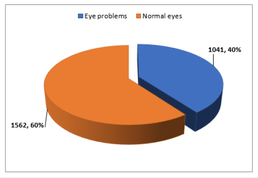 irispublishers-openaccess-ophthalmology-vision-research